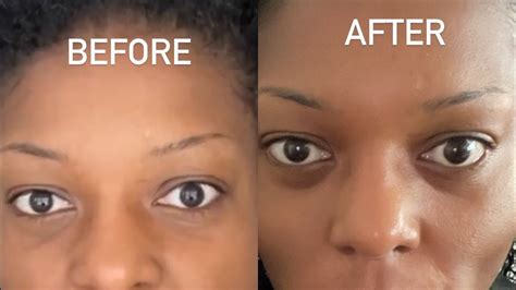 Trying New Product The Instant Puffiness Reducer With No Puffiness