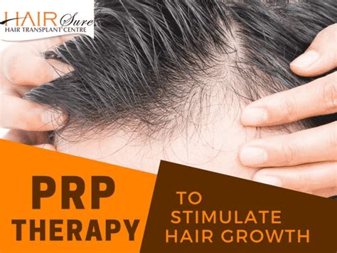 Share 67 Prp Hair Before And After Latest Vova Edu Vn