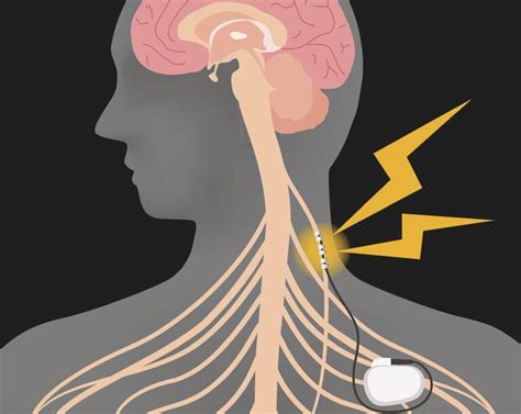 What Happens When The Vagus Nerve Is Triggered Health Life And Recipes
