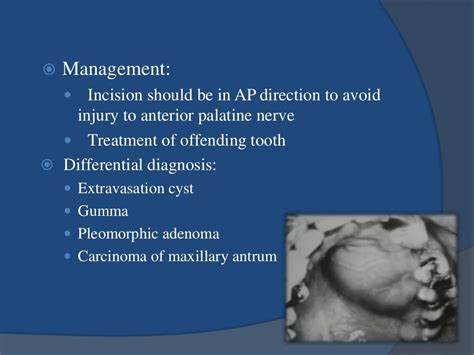 Head And Neck Infections