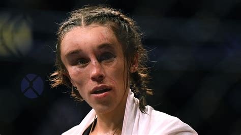 Ufc Joanna Jedrzejczyk Shows Off Remarkable Facial Recovery After