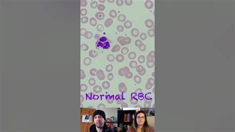 Normal Rbc Morphology Characteristics Youtube