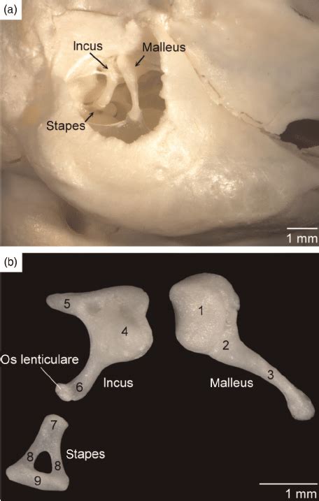 Ossicles Of The Middle Ear Of The Common Marmoset A In Situ