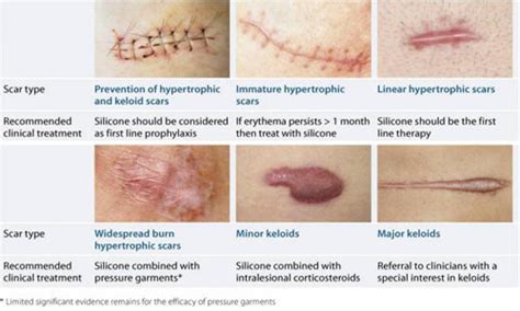 What Are Scars Dermacare