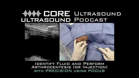 Large Joint Arthrocentesis And Injection Core Ultrasound