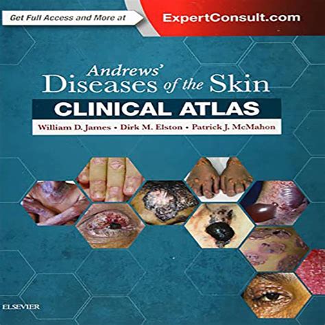 Andrews Diseases Of The Skin Clinical Atlas 9780323441964