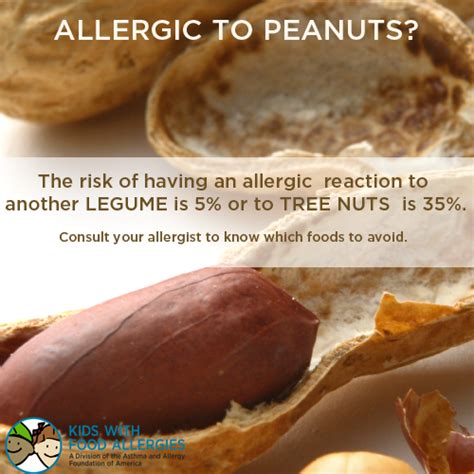 Tree Nut Allergy Milk Allergy Peanut Allergy Food Allergy Facts