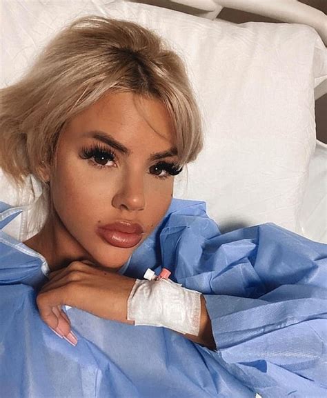 Love Islands Hannah Elizabeth Reveals The Shocking Results Of Her Facial Surgery Sound Health