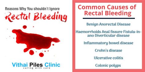 Rectal Bleeding Causes And Treatment Vithaipileshospital