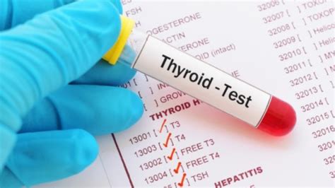 Why You May Need A Full Thyroid Panel Isabel Smith Nutrition