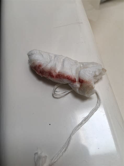 Implantation bleeding is defined as a small amount of spotting or light bleeding that occurs anywhere from 10 to 14 days after fertilization and a few days before your next menstrual cycle. Implantation Bleeding Tampon - maternity photos