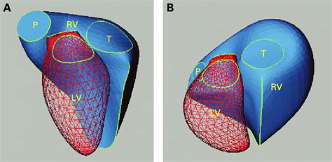 Three Dimensional Reconstructions Of The Right Ventricle Rv