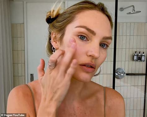 Candice Swanepoel Reveals The Crazy Veins Covering Her