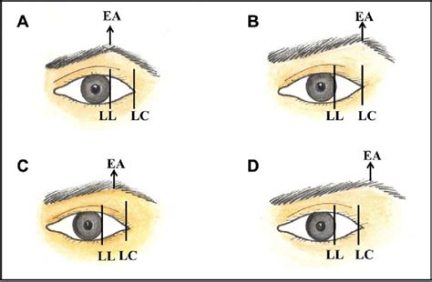 Types Of Eyebrow Apex Position A Above The Lateral Limbus B