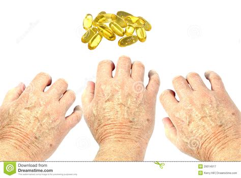 Very Dry Skin On Hands Stock Image Image Of Health Care 29314517