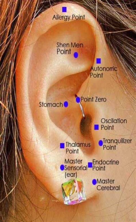 In direct examination of the ear to find ear points, the acupuncturist looks for any of the following positive responses except a) accumulations (wax or. Seniors - KWHLC