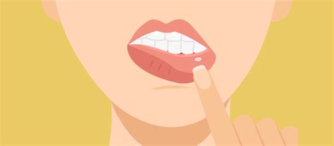 What Causes Canker Sores And How To Treat Them