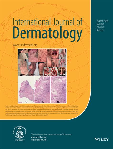 International Journal Of Dermatology Vol 61 No 4