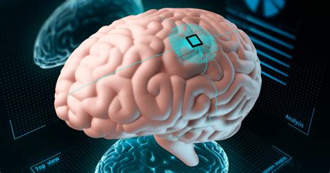 amazing breakthrough a brain implant enables a man to speak after losing the ability to speak