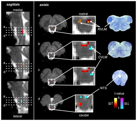 Functional Magnetic Resonance Imaging Fmri Signal Intensity Changes