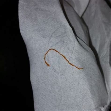 Thin Orange Worm On Toilet Paper All About Worms