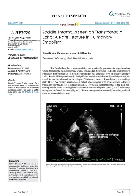 Pdf Saddle Thrombus Seen On Transthoracic Echo A Rare Feature In Pulmonary Embolism