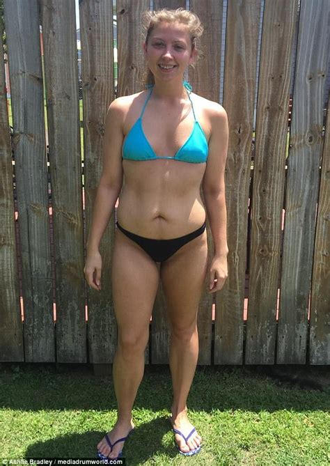 Virginia Woman Who Weighed Just 87lbs Overcomes Anorexia Daily Mail