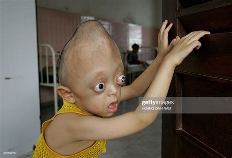 Four Year Old Boy Nguyen Xuan Minh Stands Looking Out At The Door Of