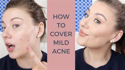 How To Cover Acne With Concealer Youtube