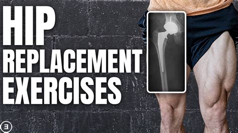 Total Hip Replacement Exercise Progressions Youtube