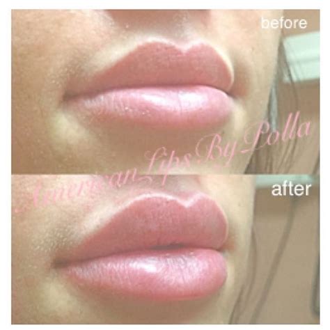 Love These Lips Lip Fillers Lip Injections Permanent Makeup Eyeliner
