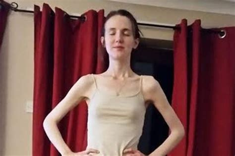 Anorexic Left Close To Death After Starving Herself On Just 17g Of Rice