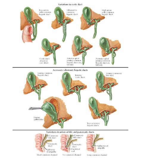 Variations In Cystic Hepatic And Pancreatic Ducts Anatomy Pediagenosis