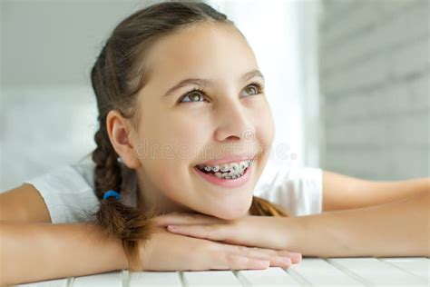 Close Up Portrait Of Smiling Teenager Girl Showing Dental Braces Isolated On White Background