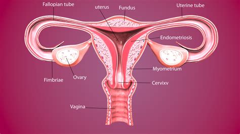 Endometrial Cancer Stages Oncsot