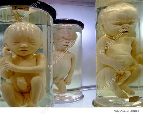 Unborn Baby Stock Image I1323840 At Featurepics
