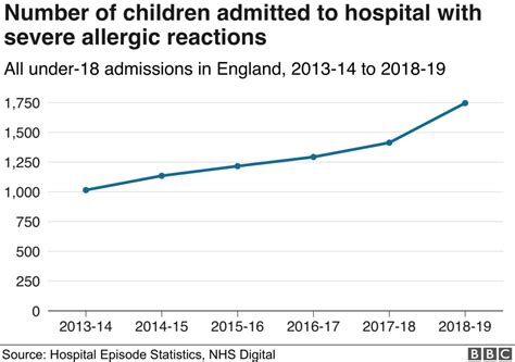 Severe Allergic Reactions Rise In Children In England Over Past Five