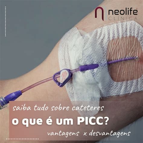 O que é o cateter PICC Neolife Clínica