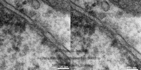 Nuclear Membrane Drjastrows Electron Microscopic Atlas