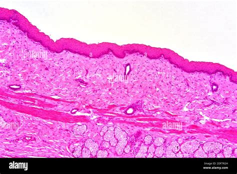 Epitelio Escamoso Estratificado Humano Músculo Liso Y Glándula