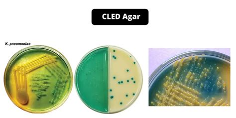 Cled Agar Composition Principle Preparation Results Uses