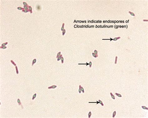 72 Examples Of Endospores Biology Libretexts