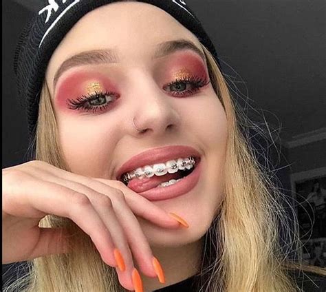 Pin By Ty 0official♥️ On Brace Face Braces Girls Teeth Braces Dental Braces