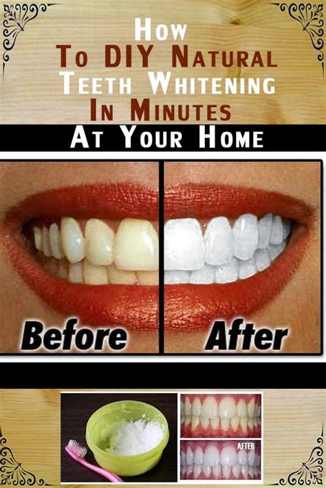 How To Diy Natural Teeth Whitening In Minutes At Your Home Natural