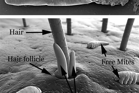 Eyelash Electron Microscope Skin Micropedia