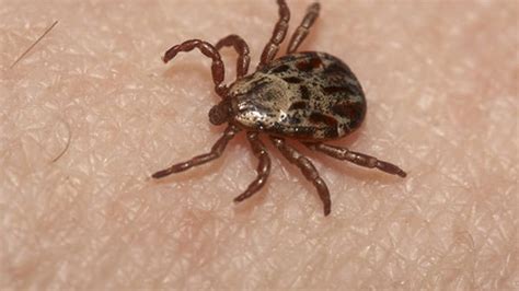 Certain Tick Bites Cause Red Meat Allergy Wstm