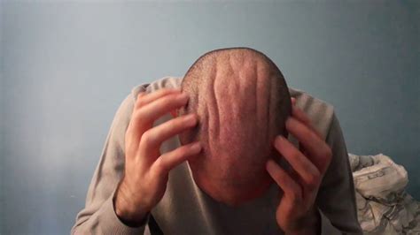 Bald Head Massage Rubbing Scratching Youtube