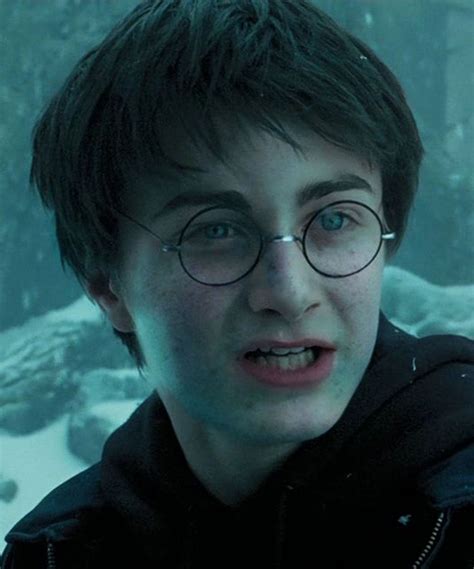 These Photos Of Harry Potter Characters With Acne Are So Relatable