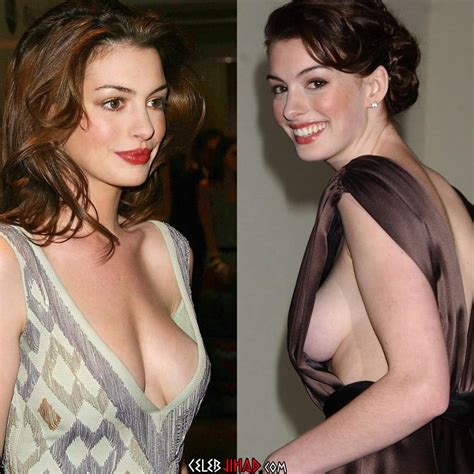Anne Hathaway Side Boob Imgur The Best Porn Website