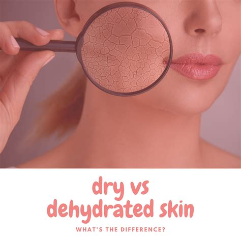 Dry Vs Dehydrated Skin Whats The Difference